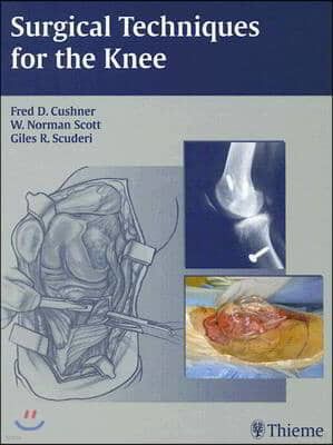 Surgical Techniques for the Knee