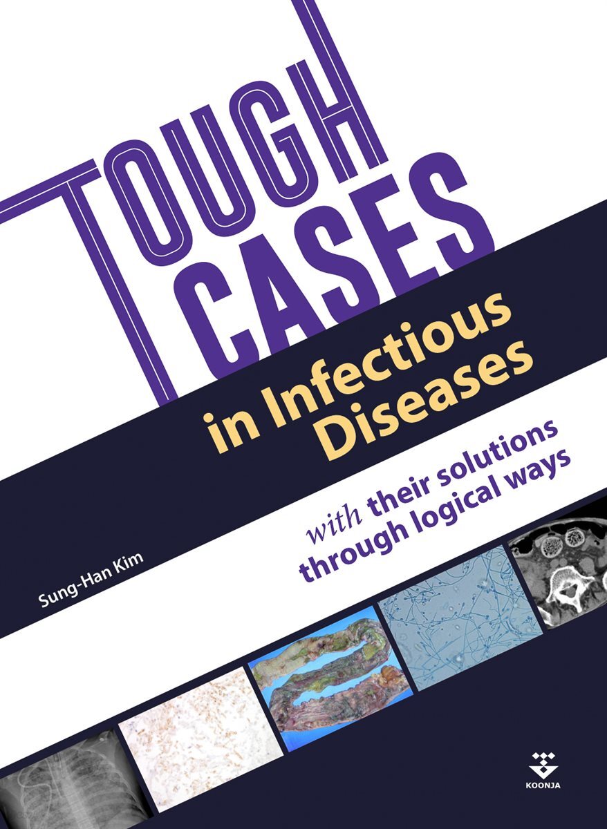 Tough Cases in Infectious Diseases with their solutions through logical ways