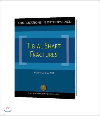 Complications in Orthopaedics: Tibial Shaft Fractures