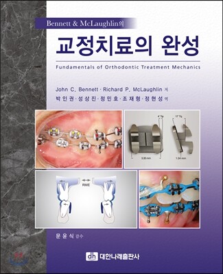 교정치료의 완성