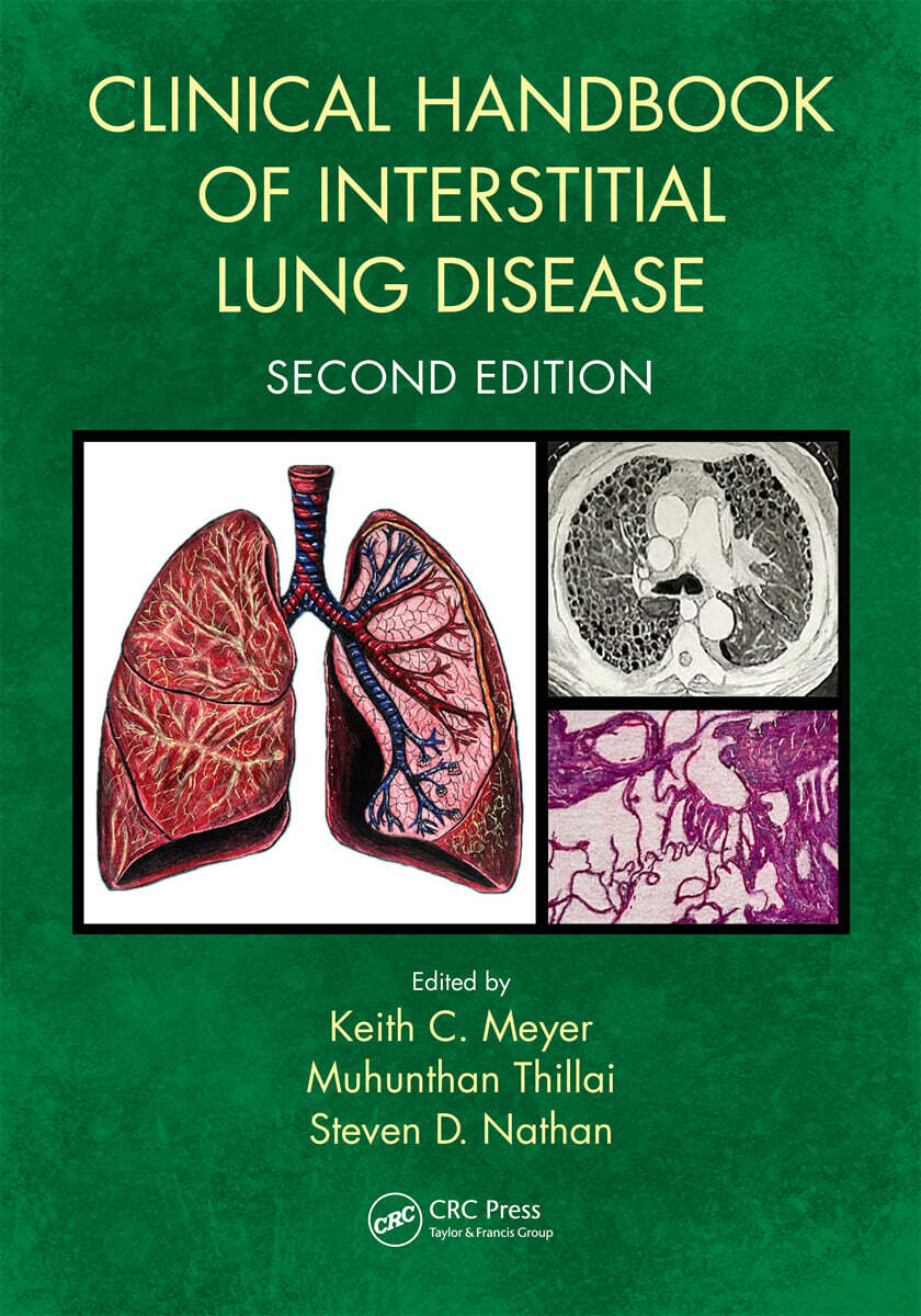 Clinical Handbook of Interstitial Lung Disease