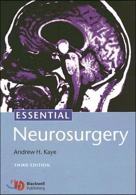 Essential Neurosurgery