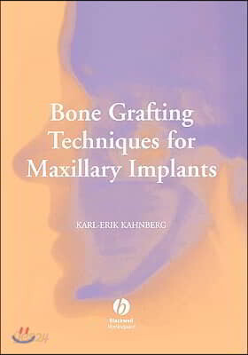 Bone Grafting Techniques for Maxillary Implants