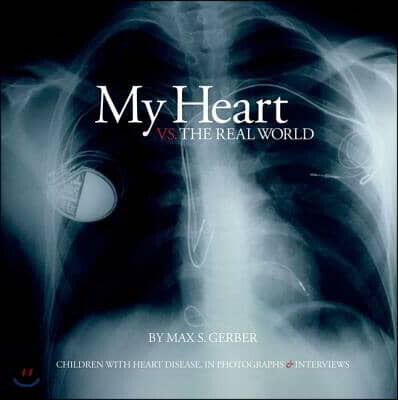 My Heart vs. the Real World: Children with Heart Disease, in Photographs and Interviews