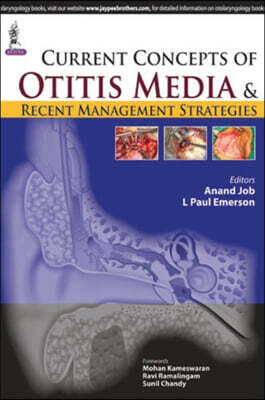 Jp Medical Pub Current Concepts of Otitis Media and Recent Management Strategies