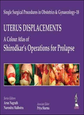 Uterus Displacements