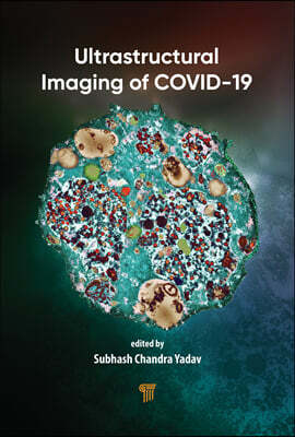 Ultrastructural Imaging of COVID-19