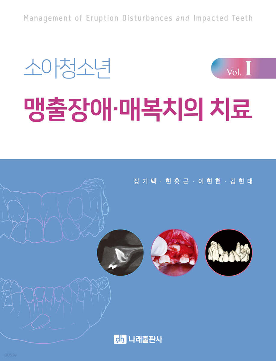 소아청소년 맹출장애·매복치의 치료 Vol.1
