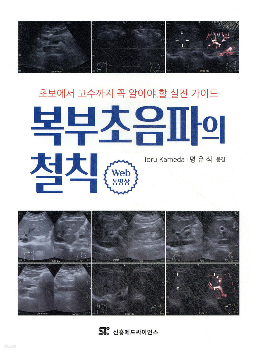 복부초음파의 철칙