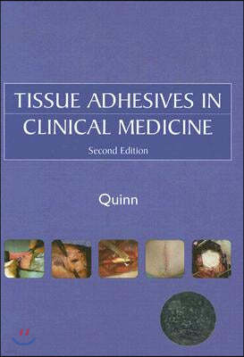 Tissue Adhesives in Clinical Medicine