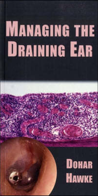 Managing the Draining Ear