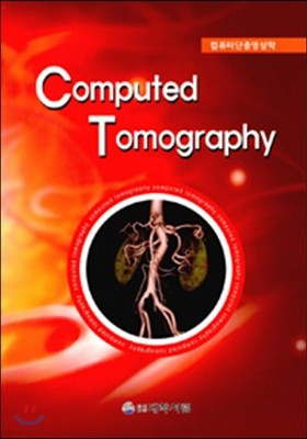 Computed Tomography