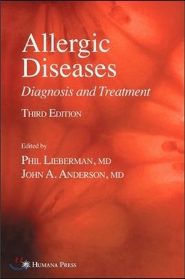 Allergic Diseases: Diagnosis and Treatment