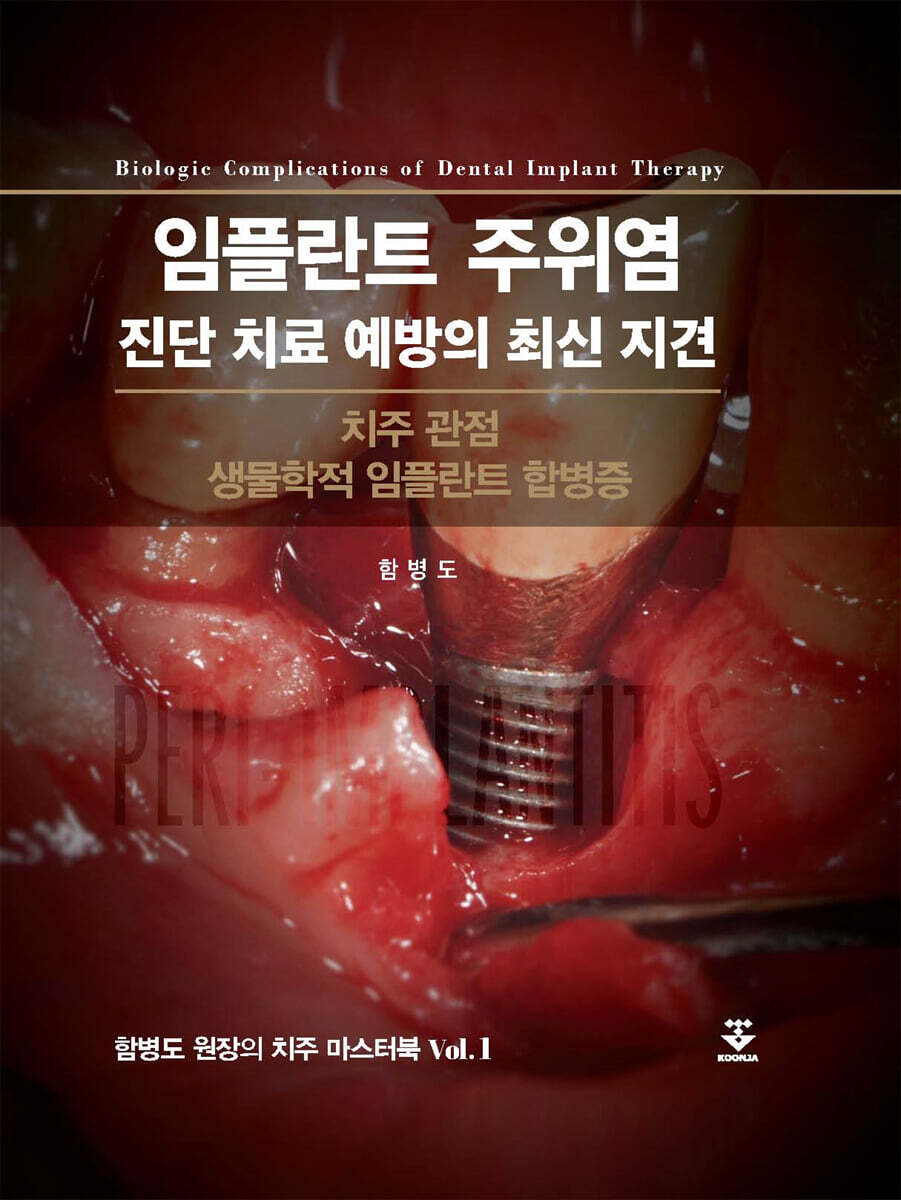 임플란트 주위염 진단 치료 예방의 최신 지견