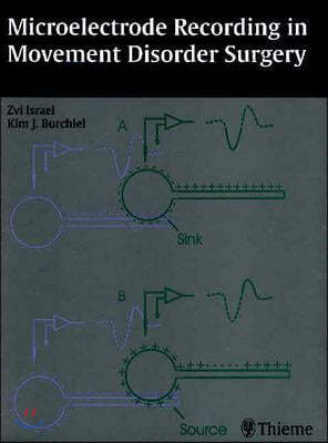 Microelectrode Recording in Movement Disorder Surgery