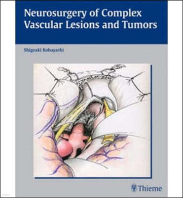Neurosurgery Of Complex Vascular Lesions And Tumors