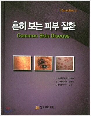 흔히보는 피부질환