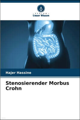 Verlag Unser Wissen Stenosierender Morbus Crohn