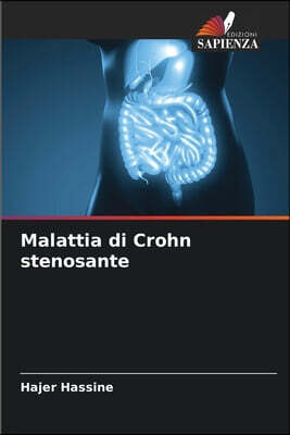 Edizioni Sapienza Malattia di Crohn stenosante