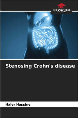 Our Knowledge Publishing Stenosing Crohn's disease