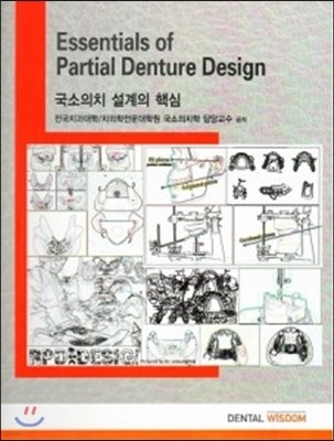 Essentials of Partial Denture Design 