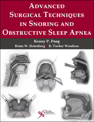 Advanced Surgical Techniques in Snoring and Obstructive Sleep Apnea