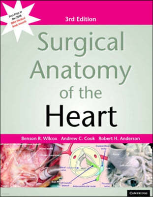 Surgical Anatomy Of The Heart
