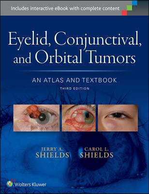 Eyelid, Conjunctival, and Orbital Tumors: An Atlas and Textbook