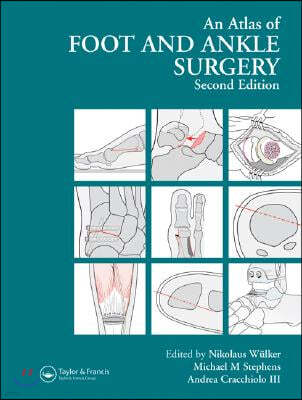 Atlas Foot and Ankle Surgery