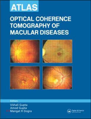 Atlas of Optical Coherence Tomography of Macular Diseases
