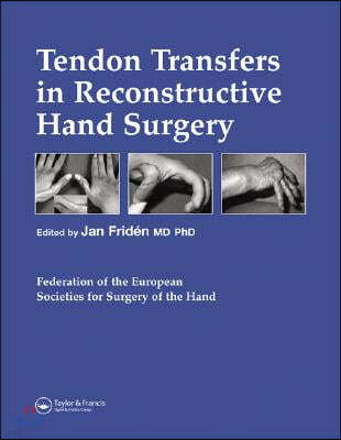 Tendon Transfers in Reconstructive Hand Surgery
