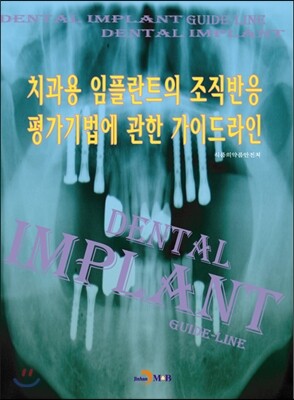진한엠앤비  치과용 임플란트의 조직반응 평가기법에 관한 가이드라인