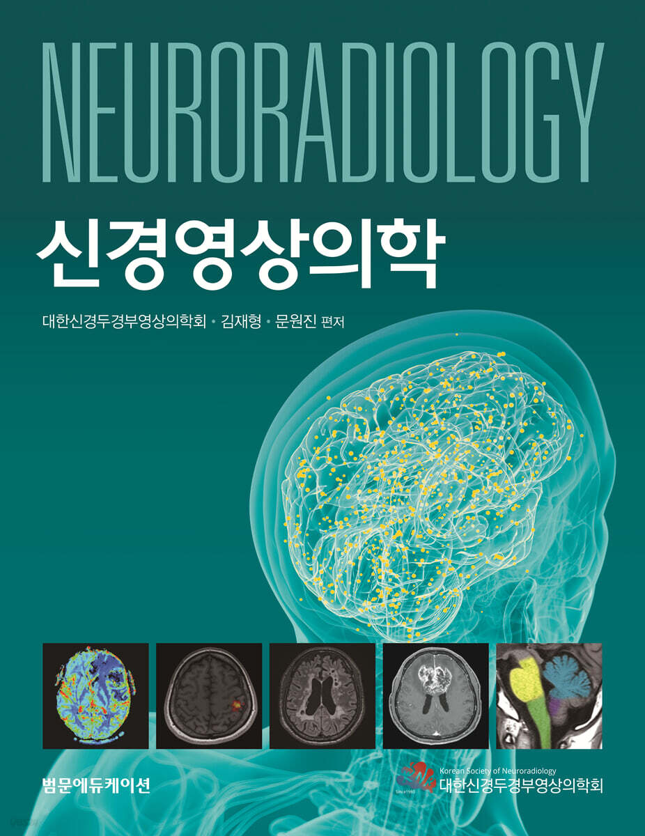 신경영상의학