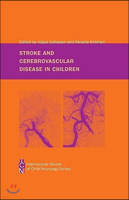 Stroke and Cerebrovascular Disease in Childhood