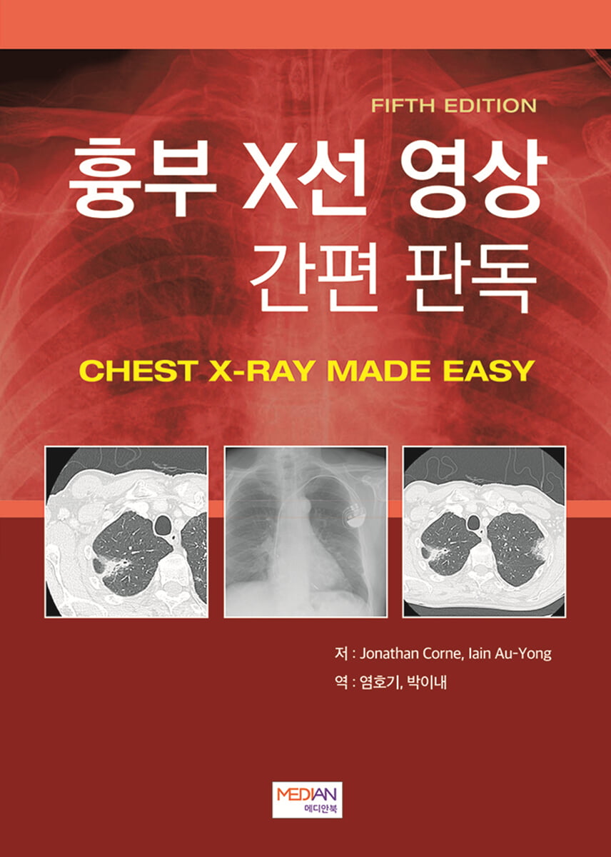 흉부 X선 영상 간편 판독(Chest X-Ray Made Easy)
