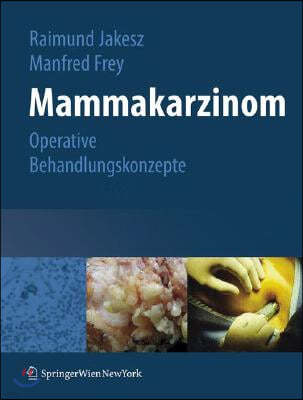 Mammakarzinom: Operative Behandlungskonzepte