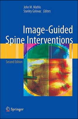 Image-Guided Spine Interventions