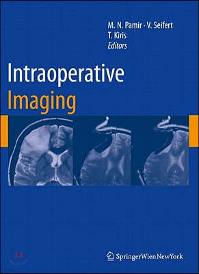 Intraoperative Imaging