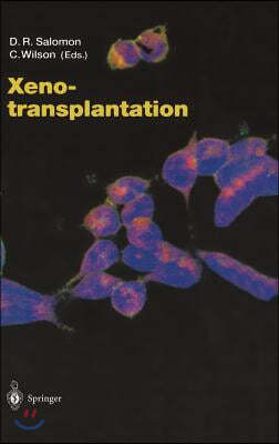 Xenotransplantation