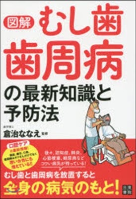 圖解 むし齒.齒周病の最新知識と予防法