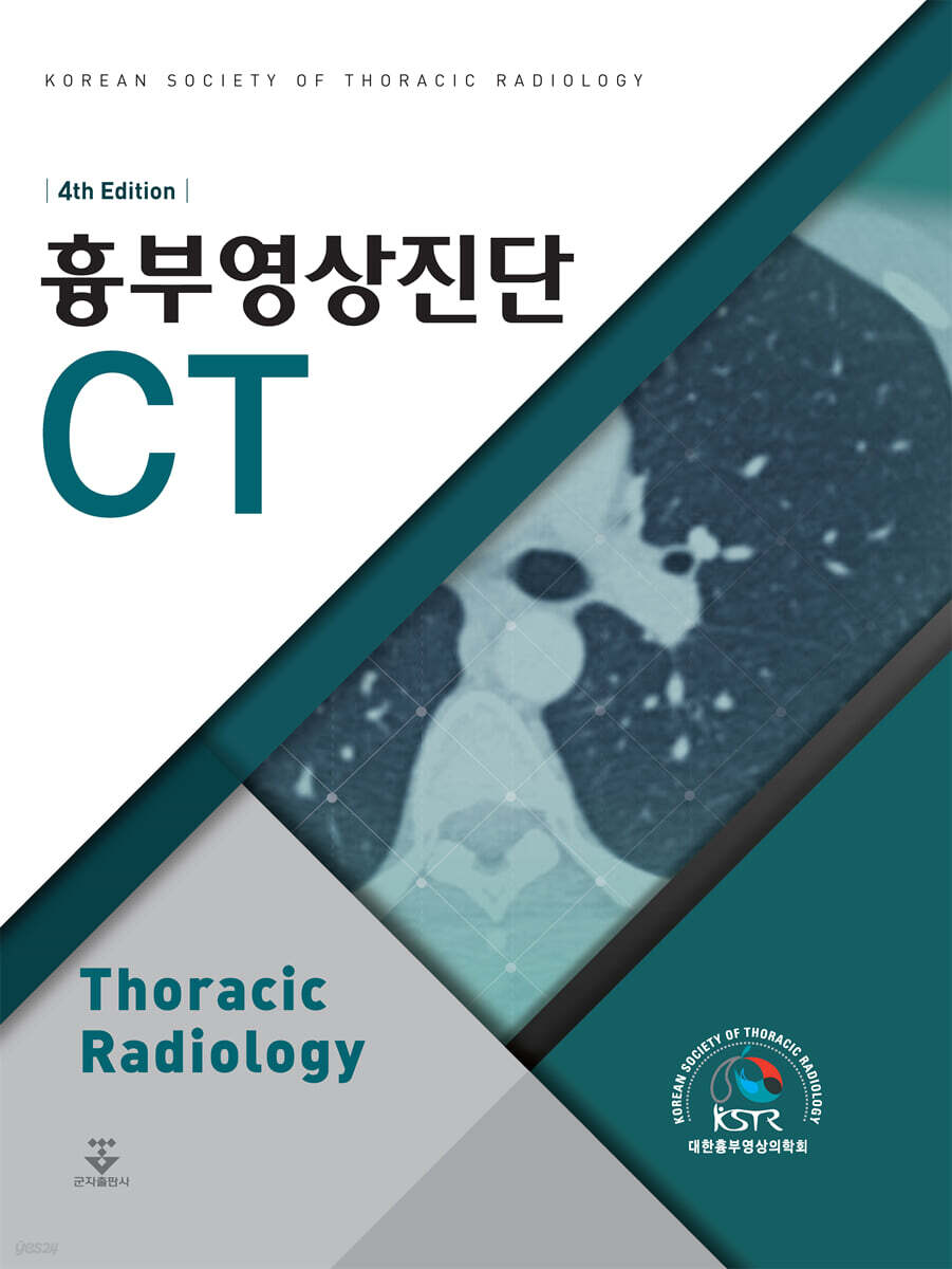 흉부영상진단 CT