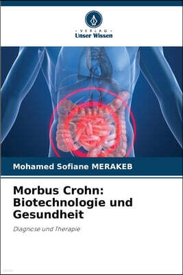 Verlag Unser Wissen Morbus Crohn: Biotechnologie und Gesundheit