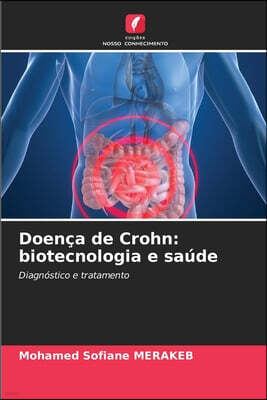 Edicoes Nosso Conhecimento Doenca de Crohn: biotecnologia e saude