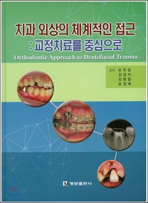 치과 외상의 체계적인 접근