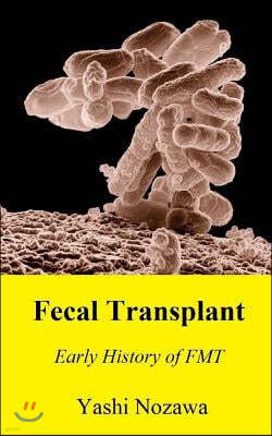 Fecal Transplant: Early History of FMT