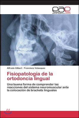 Fisiopatologia de la ortodoncia lingual