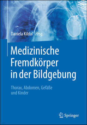 Medizinische Fremdkorper in Der Bildgebung: Thorax, Abdomen, Gefae Und Kinder