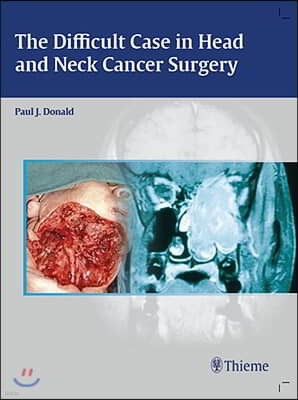 The Difficult Case in Head And Neck Cancer Surgery