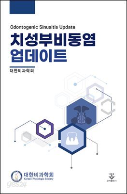 치성부비동염 업데이트