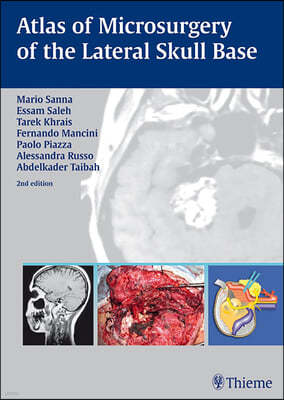 Atlas of Microsurgery of the Lateral Skull Base